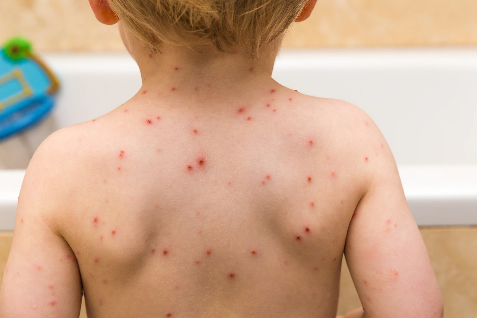 🔴 Skin Issues (Eczema, Rashes, Bumps)